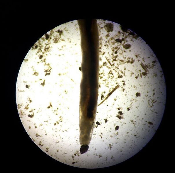 File:Annelida Amelida.jpg