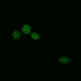 WT SOD1, induction with 10 min. heat shock at 50°C