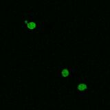 WT SOD1, induction with 1:100 paromomycin dilution (140 μM)