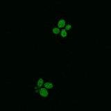WT SOD1, induction with 1:1500 paromomycin dilution (9.3 μM)