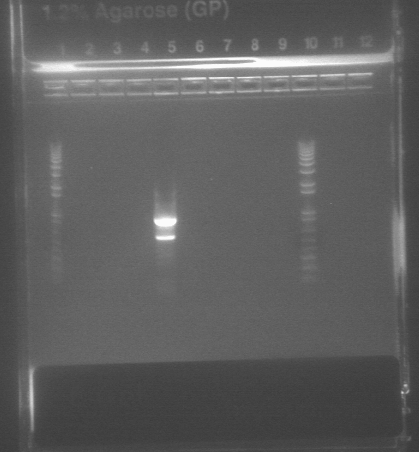 File:83gelpcrvp16.jpg px-240