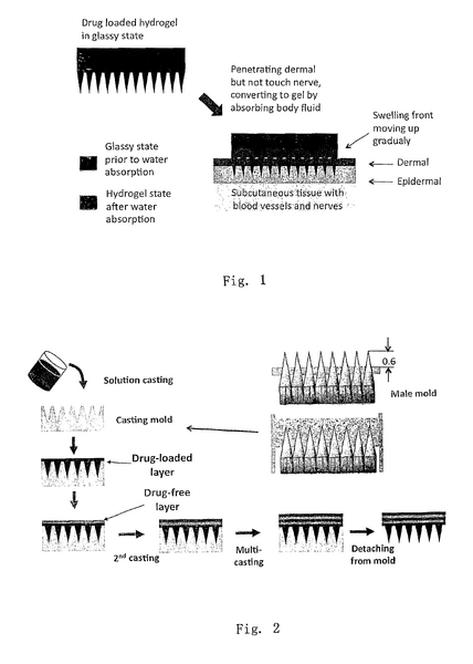 File:BME100 Group6 MicroNeedle1.png