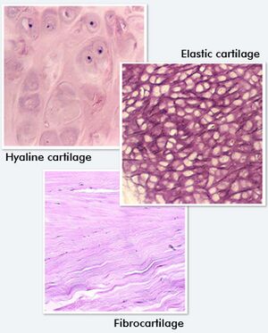 Hyaline cartilage vs Fibrocartilage [14]