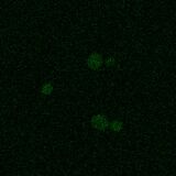 A4V SOD1, induction at 42°C