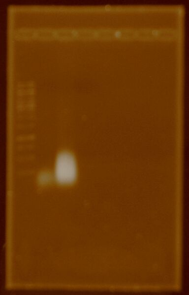 File:WITH DNASE 4REAL.JPG