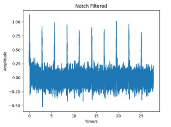 Figure 2.4c: Notch Filter applied to the previous signal to remove 50Hz signal