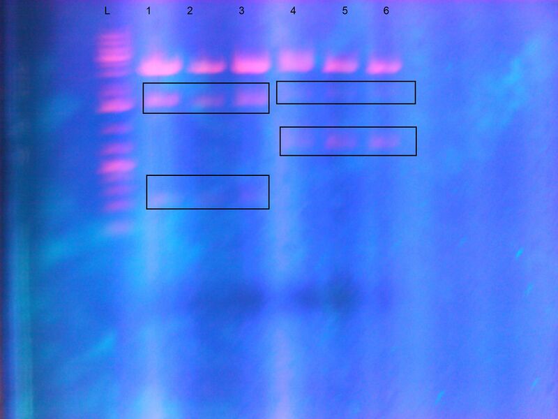File:Gel Results Cloning.jpg