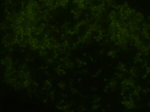 Raw Data of Yeast at 10 hours