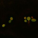 A4V SOD1, induction with 1:100 paromomycin dilution (140 μM)