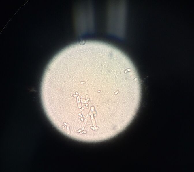 File:Wet mount nut 10^-3.jpg