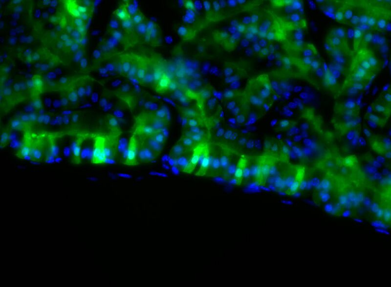 File:GFP Hoechst1.jpg