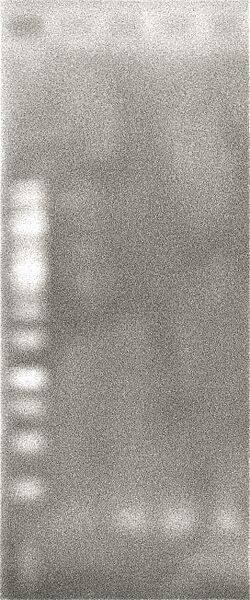 File:ColonyPCR 26Sep2010.JPG