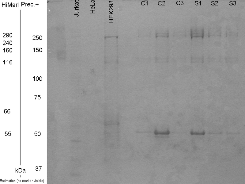 File:SDS-page after blot 100810.tif