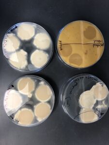 Representative images of co-culture, bottom view.