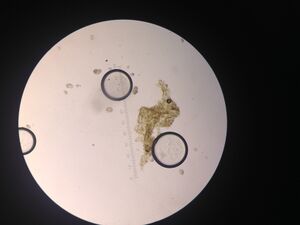 Picture of colpidium by bubble.