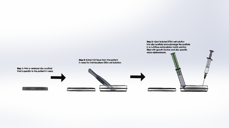 File:Rsz 1overall procedure.png