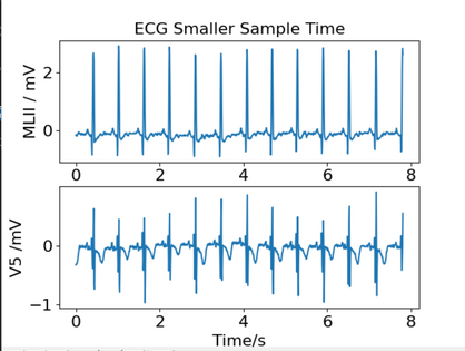Input and Display Smaller Sample of ECG