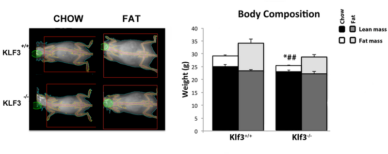 File:Dexa and body comp.png