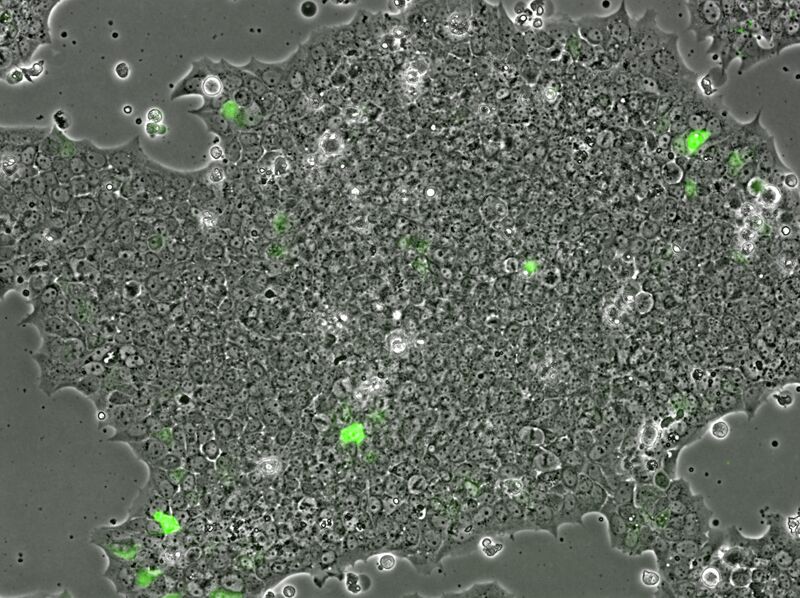 File:2015-10-27 Well 2 phase GFP 10x.jpg