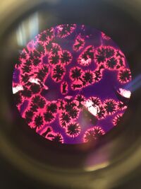 Picture of 100-fold Serial Dilution results from the Hay Fusion Culture