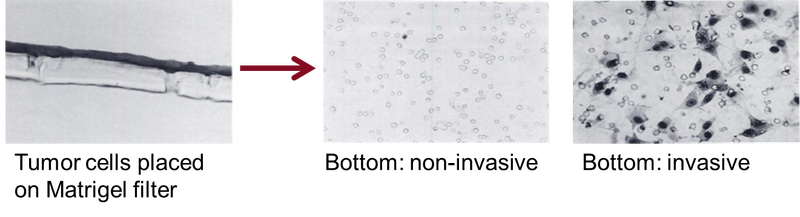 File:Tumor Invade Assay.png