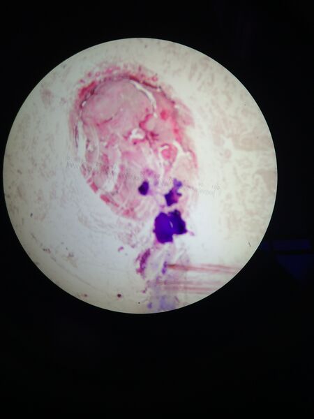 File:10^-3 no tet.jpg