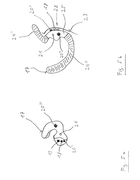 File:BME100 Group3 W1030 Patent1Picture2.png