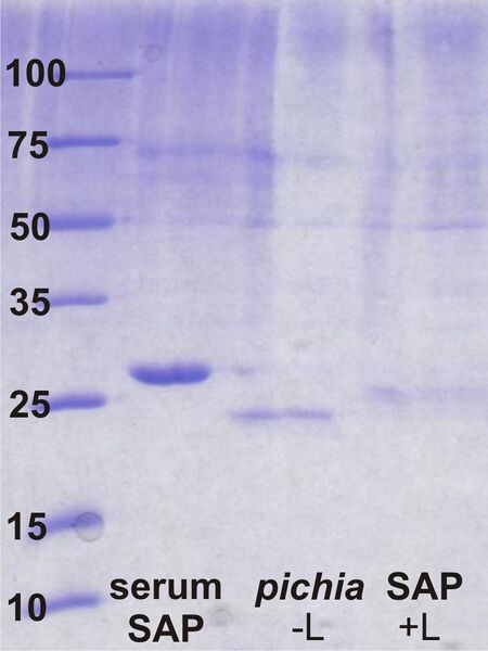 File:SAP gel labels.JPG