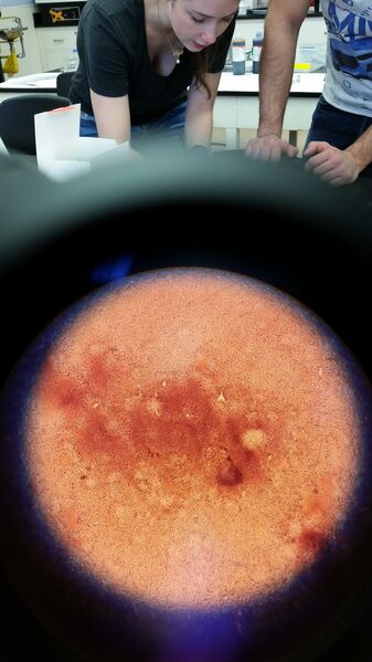 File:Gram negative 10^-5 non-TET.jpg