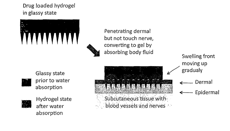 File:MicroNeedle.png