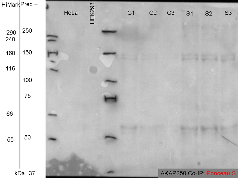 File:10072010 Ponceau.png