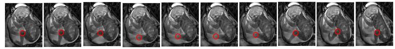Fetal Movement Image