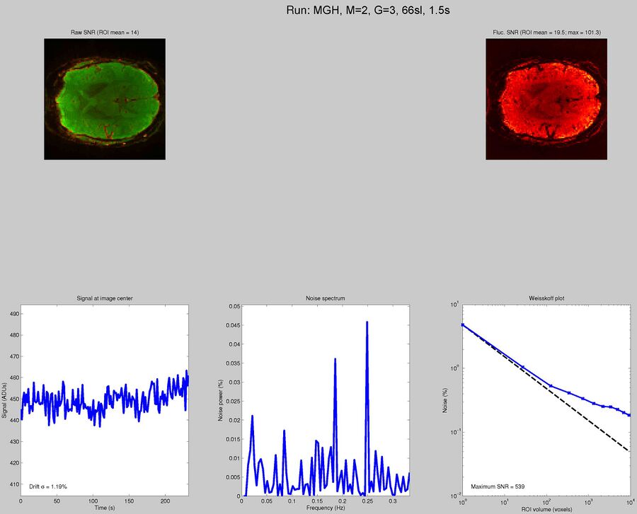 MGH Blipped CAIPI multi-band EPI with SMS 2, GRAPPA 3, TR = 1.5 seconds