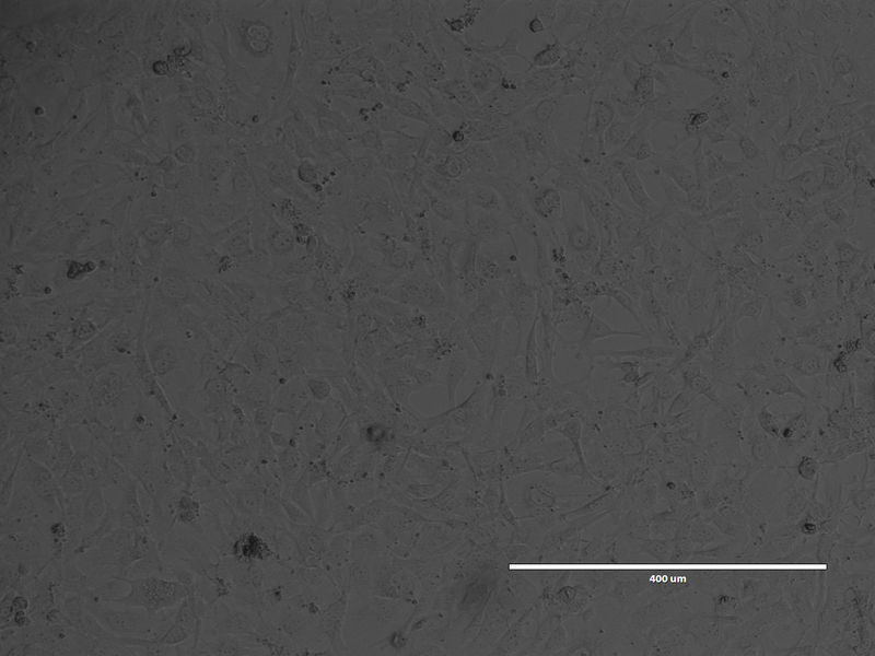 File:11-23-2015 BT549 confluent.tif