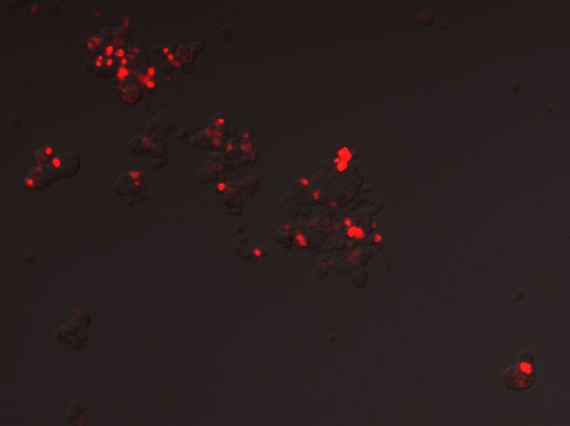 File:Bl09 + 4uL Captured Bright Field.jpg