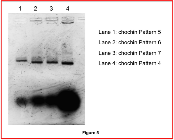 Fig.5 electrophorese2