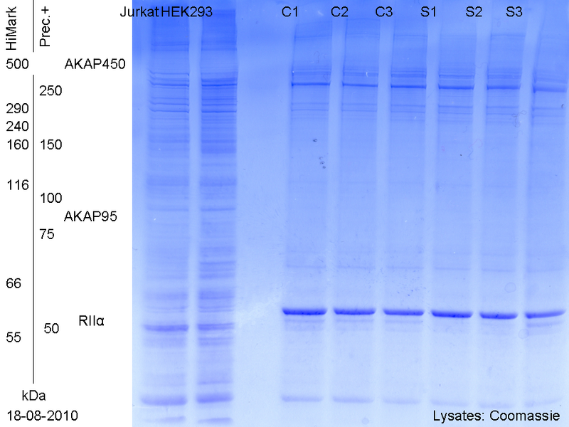 File:Coomassie gel after blot 18.8.10.tif