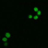 WT SOD1, induction at 30°C