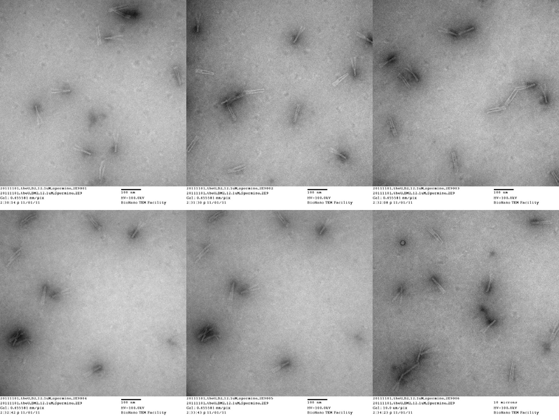 File:20111101 theU B2 12 1umSpermin 2E9.png