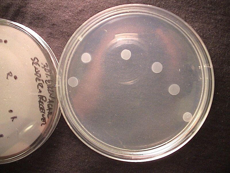 File:30EikenAgar Sender+Receiver 8hours.JPG