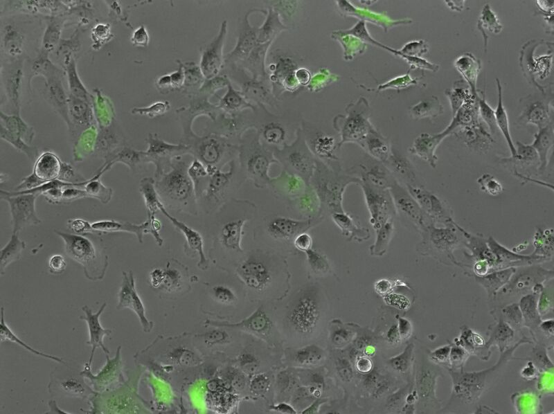 File:2015-10-21 Well 5 phase GFP 10x.jpg