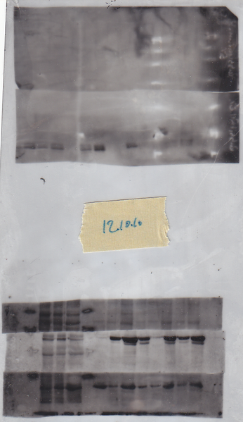 File:12102010 6% & 10% gels hTERT.tif