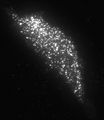 File:Trpc5 tirf 01.tif