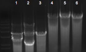 File:KAH 122909 gel2.tif