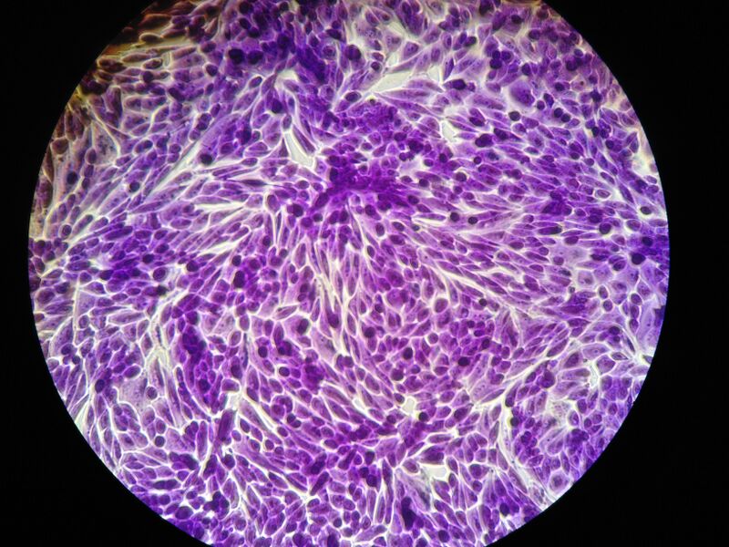 File:Nice kidneys.jpg