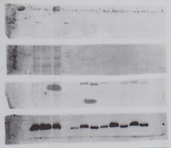 File:19102010 10% gel hTERT.tif