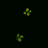WT SOD1, induction with 1:1500 paromomycin dilution (9.3 μM)