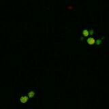 WT SOD1, induction with 1:4 paromomycin dilution (3.5 mM)