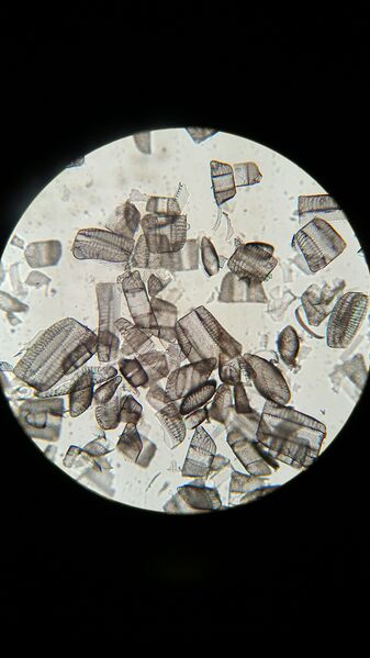 File:20160121 152405.jpg