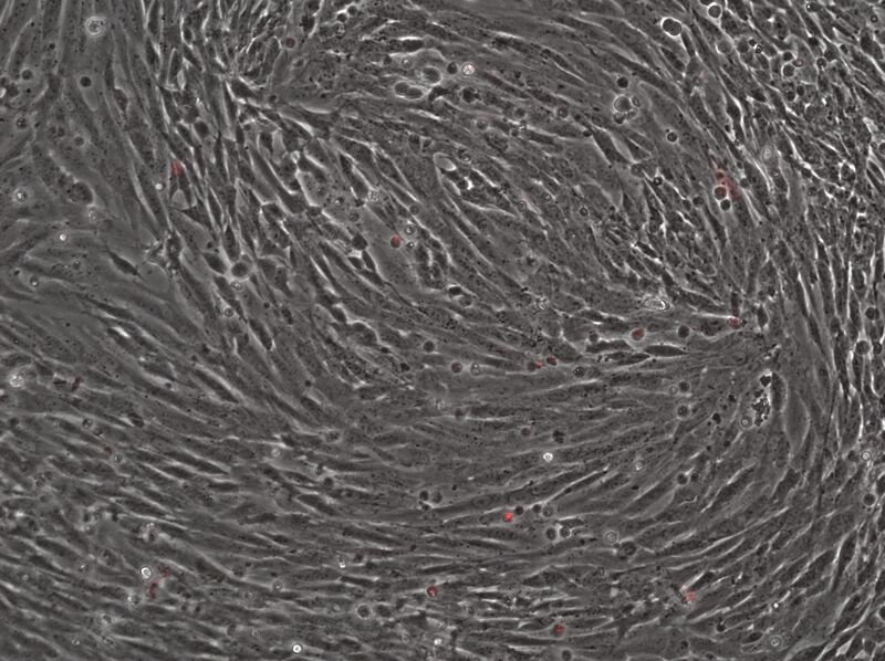 File:2015-02-02 Well 4 phase mCherry 10x.jpg